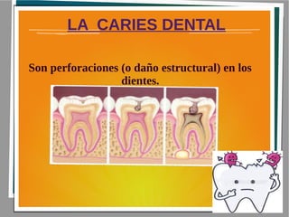 LA CARIES DENTAL
Son perforaciones (o daño estructural) en los
dientes.
 