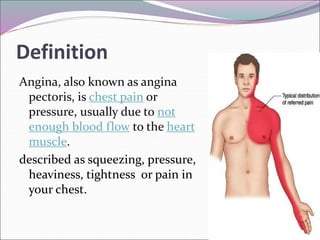 angina.ppt