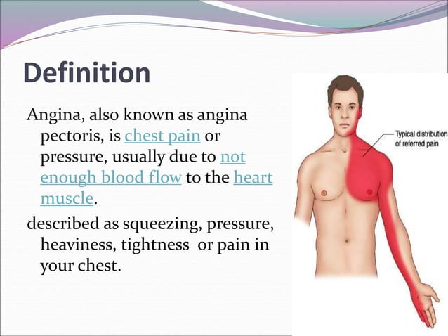 angina.ppt