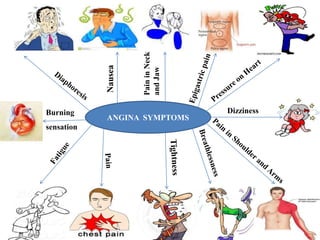 ANGINA.pptx