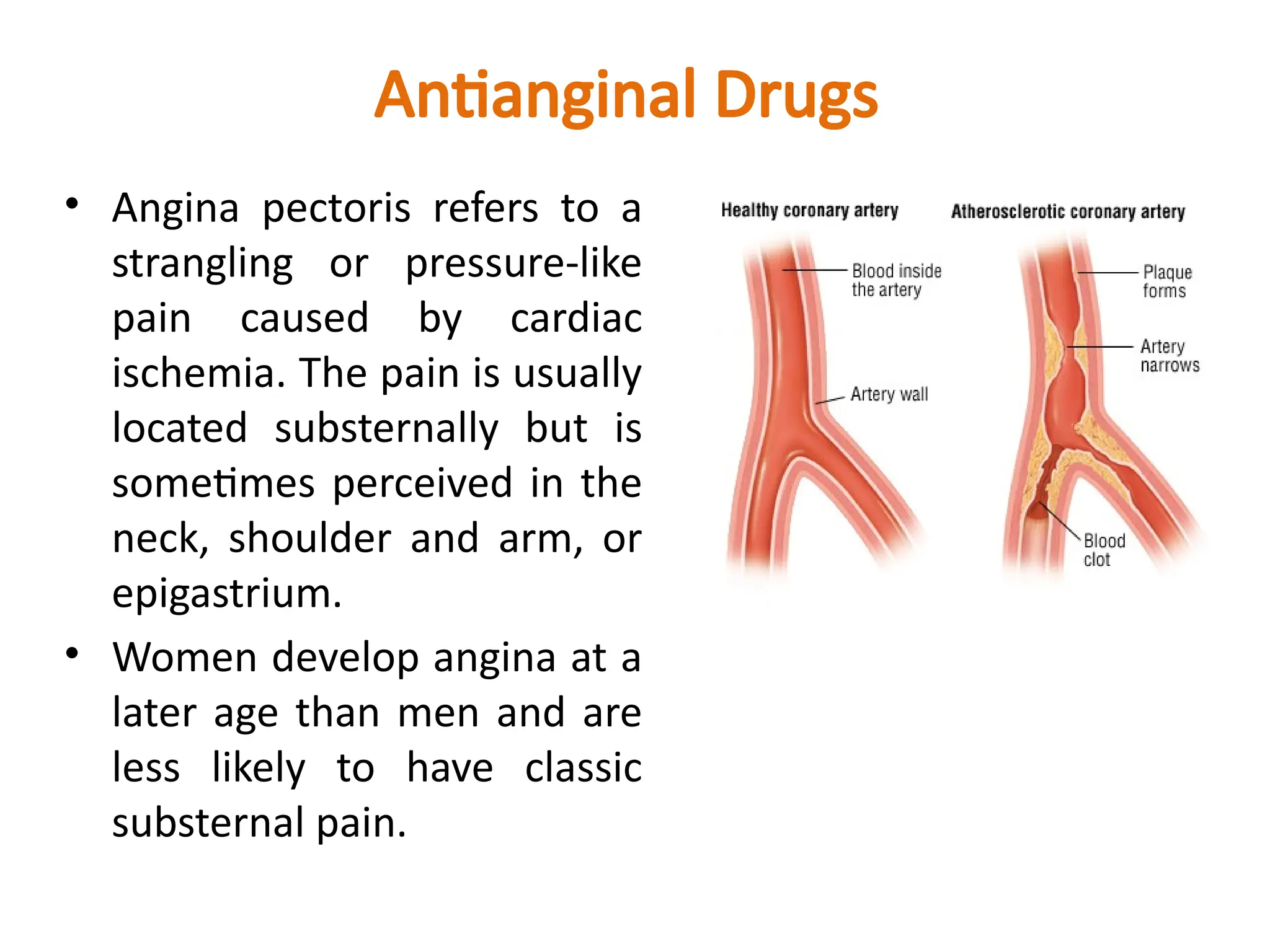 Antianginal Drugs
• Angina pectoris refers to a
strangling or pressure-like
pain caused by cardiac
ischemia. The pain is usually
located substernally but is
sometimes perceived in the
neck, shoulder and arm, or
epigastrium.
• Women develop angina at a
later age than men and are
less likely to have classic
substernal pain.
 
