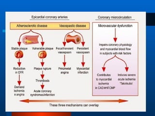Angina and Myocardial Infarction Pharmacology.ppt