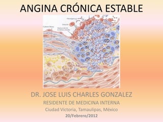 ANGINA CRÓNICA ESTABLE




 DR. JOSE LUIS CHARLES GONZALEZ
    RESIDENTE DE MEDICINA INTERNA
     Ciudad Victoria, Tamaulipas, México
              20/Febrero/2012
 