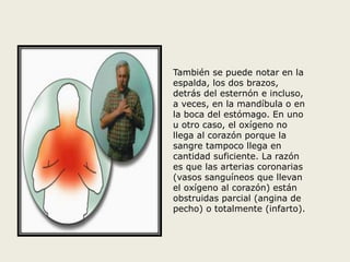 También se puede notar en la 
espalda, los dos brazos, 
detrás del esternón e incluso, 
a veces, en la mandíbula o en 
la boca del estómago. En uno 
u otro caso, el oxígeno no 
llega al corazón porque la 
sangre tampoco llega en 
cantidad suficiente. La razón 
es que las arterias coronarias 
(vasos sanguíneos que llevan 
el oxígeno al corazón) están 
obstruidas parcial (angina de 
pecho) o totalmente (infarto). 
