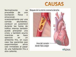 Normalmente va 
precedida de una 
excitación física o 
emocional; 
ocasionalmente por una 
comida abundante; 
conducir un automóvil 
durante las horas de 
tráfico intenso también 
puede precipitar una 
crisis; y también ocurre 
mientras se hace 
ejercicio en un 
ambiente frío, en cuyo 
caso hay pacientes que 
experimentan alivio 
casi inmediato al pasar 
de una habitación fría a 
otra caliente. 
 