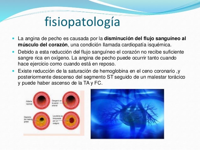 Vertebrogennye los síndromes de la osteocondrosis