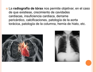 

La radiografía de tórax nos permite objetivar, en el caso
de que existiese, crecimiento de cavidades
cardiacas, insuficiencia cardiaca, derrame
pericárdico, calcificaciones, patología de la aorta
torácica, patología de la columna, hernia de hiato, etc.

 