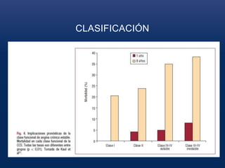 CLASIFICACIÓN
 