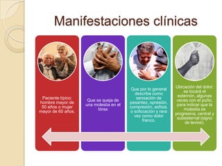 Manifestaciones clínicas



                                                                Ubicación del dolor:
                                          Que por lo general
                                                                    se tocará el
                                           describe como
                                                                 esternón, algunas
 Paciente típico:                           sensación de
                     Que se queja de                             veces con el puño,
hombre mayor de                          pesantez, opresión,
                    una molestia en el                           para indicar que la
 50 años o mujer                         compresión, asfixia,
                          tórax                                     molestia es
mayor de 60 años.                        o sofocación y rara
                                                                progresiva, central y
                                           vez como dolor
                                                                 subesternal (signo
                                               franco.
                                                                     de levine).
 