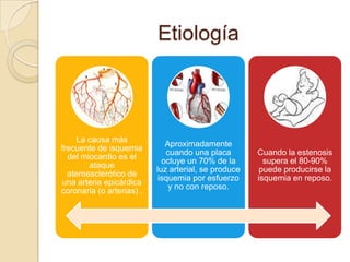 Etiología



    La causa más
                              Aproximadamente
frecuente de isquemia
                              cuando una placa        Cuando la estenosis
  del miocardio es el
                             ocluye un 70% de la        supera el 80-90%
        ataque
                           luz arterial, se produce    puede producirse la
  ateroesclerótico de
                            isquemia por esfuerzo     isquemia en reposo.
una arteria epicárdica
                               y no con reposo.
coronaria (o arterias) .
 