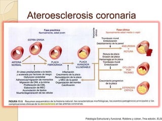 Ateroesclerosis coronaria




             Patología Estructural y funcional, Robbins y cotran, 7ma edición, ELSE
 
