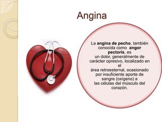 Angina

   La angina de pecho, también
       conocida como angor
             pectoris, es
      un dolor, generalmente de
  carácter opresivo, localizado en
                   el
   área retroesternal, ocasionado
      por insuficiente aporte de
         sangre (oxígeno) a
     las células del músculo del
               corazón.
 