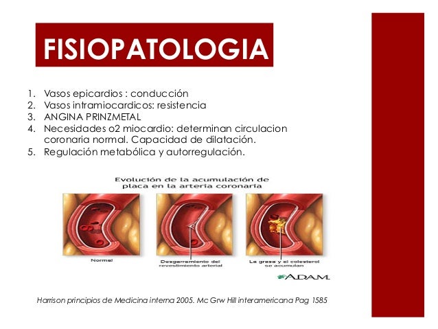 ANGINA DE PRINZMETAL FISIOPATOLOGIA PDF