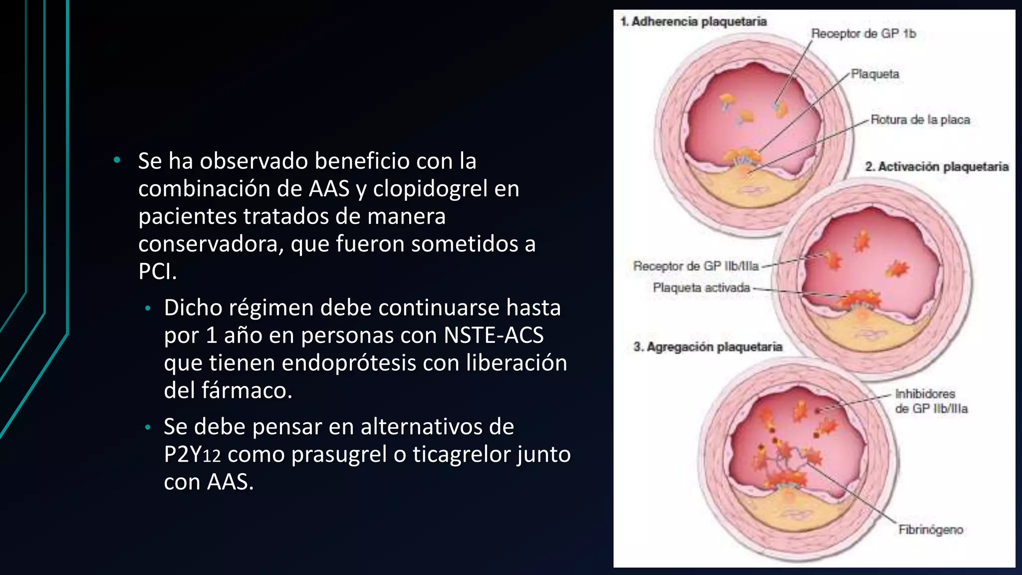 Angina de pecho inestable e infarto del miocardio sin elevacion del ...