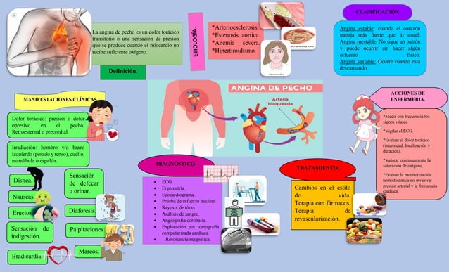 Angina de pecho y infarto agudo al miocardio