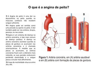 O que é a angina de peito?

 A Angina de peito é uma dor ou
desconforto no peito quando os
músculos cardíacos não recebem
sangue suficiente.
A Angina pode ser sentida como
uma pressão ou aperto no peito. A dor
também pode ser nos ombros, braços,
pescoço, ou nas costas.
Angina é um sintoma de doença na
artéria coronária, o tipo mais comum
de doença cardíaca. A doença na
artéria coronária acontece quando as
placas de gordura se acumulam nas
artérias coronárias e é chamado
arteriosclerose. À medida que as
placas se acumulam, as artérias
coronárias ficam com o diâmetro mais
reduzido, as suas paredes endurecem
perdendo elasticidade e o sangue
passa a circular mais dificilmente.
A taxa de mortalidade situa-se entre
3% a 4%.
 