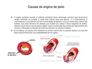 Causas da angina de peito


  A angina acontece quando as artérias coronárias ficam demasiado estreitas para fornecerem
   sangue suficiente ao coração. A razão mais comum para esta doença é a arterosclerose. A
   arterosclerose é uma doença que leva à acumulação de gordura, a que se chama placa, dentro das
   artérias. Essa placa forma-se em pedaços que acabam por reduzir o fluxo sanguíneo da artéria.
   Existem causas menos comuns para a angina, como a compressão das artérias por algo próximo das
   mesmas, inflamação ou infecção das artérias e doenças nas válvulas cardíacas.
 Os fumadores, as pessoas com colesterol ou tensão arterial alta, as pessoas obesas e os que não
  fazem exercício físico têm mais probabilidades de ter angina.
 
