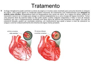 Tratamento
   A droga nitroglicerina pode controlar as dores da angina e é muitas vezes receitada para consumo durante os ataques
    de angina. Uma angina ligeira ou moderada poderá necessitar de tratamento com medicamentos que alarguem as
    artérias como nitratos, bloqueadores beta ou bloqueadores dos canais de cálcio. Se a angina for grave, poderá ser
    necessário recorrer-se à cirurgia para alargar as artérias (angioplastia) ou a uma cirurgia de bypass coronário. Tomar
    uma pequena dose de aspirina todos os dias pode ajudar a evitar coágulos sanguíneos e reduz o risco de ataques
    cardíacos, por isso, é frequentemente receitada uma dose diária de aspirina aos pacientes com angina. Em caso de
    colesterol elevado, podem ser receitadas estatinas, um medicamento que ajuda a baixar o nível de colesterol no
    sangue e a tornar o desenvolvimento de sintomas de angina menos provável.
 