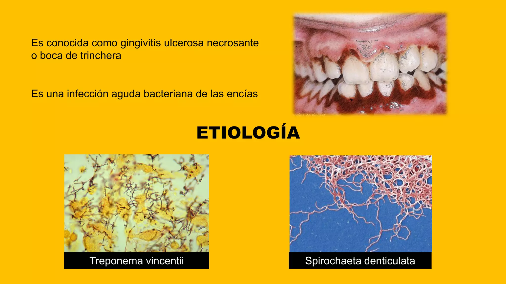 Angina De Vicent Y Ludwig PDF angina-de-vicent-y-ludwig-pdf