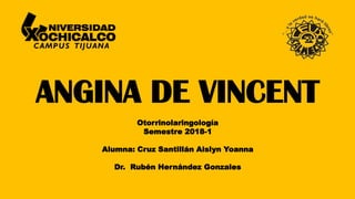 ANGINA DE VINCENT
Otorrinolaringología
Semestre 2018-1
Alumna: Cruz Santillán Aislyn Yoanna
Dr. Rubén Hernández Gonzales
 