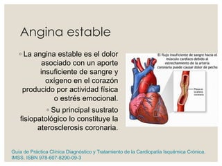 Angina estable
◦ La angina estable es el dolor
asociado con un aporte
insuficiente de sangre y
oxígeno en el corazón
producido por actividad física
o estrés emocional.
◦ Su principal sustrato
fisiopatológico lo constituye la
aterosclerosis coronaria.
Guía de Práctica Clínica Diagnóstico y Tratamiento de la Cardiopatía Isquémica Crónica.
IMSS. ISBN 978-607-8290-09-3
 