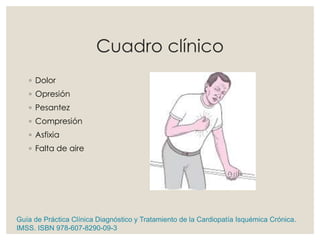 Cuadro clínico
◦ Dolor
◦ Opresión
◦ Pesantez
◦ Compresión
◦ Asfixia
◦ Falta de aire
Guía de Práctica Clínica Diagnóstico y Tratamiento de la Cardiopatía Isquémica Crónica.
IMSS. ISBN 978-607-8290-09-3
 