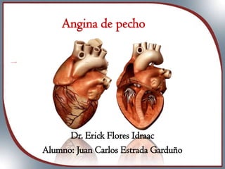Angina de pecho

Dr. Erick Flores Idraac
Alumno: Juan Carlos Estrada Garduño

 