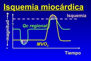 Isquemia miocárdica Tiempo magnitud - + ? MVO 2 Qc regional Isquemia 
