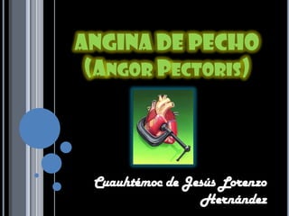 ANGINA DE PECHO(AngorPectoris) Cuauhtémoc de Jesús Lorenzo Hernández  