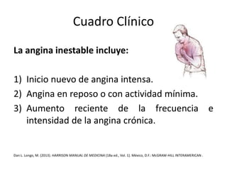 Cuadro Clínico 
La angina inestable incluye: 
1) Inicio nuevo de angina intensa. 
2) Angina en reposo o con actividad mínima. 
3) Aumento reciente de la frecuencia e 
intensidad de la angina crónica. 
Dan L. Longo, M. (2013). HARRISON MANUAL DE MEDICINA (18a ed., Vol. 1). México, D.F.:McGRAW-HILL INTERAMERICAN . 
 