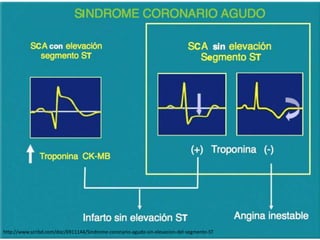 http://www.scribd.com/doc/6911144/Sindrome-coronario-agudo-sin-elevacion-del-segmento-ST 
 