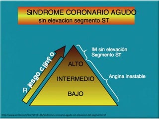http://www.scribd.com/doc/6911144/Sindrome-coronario-agudo-sin-elevacion-del-segmento-ST 
 