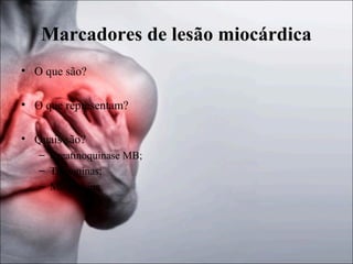 Marcadores de lesão miocárdica
• O que são?
• O que representam?
• Quais são?
– Creatinoquinase MB;
– Troponinas;
– Mioglobina.

 