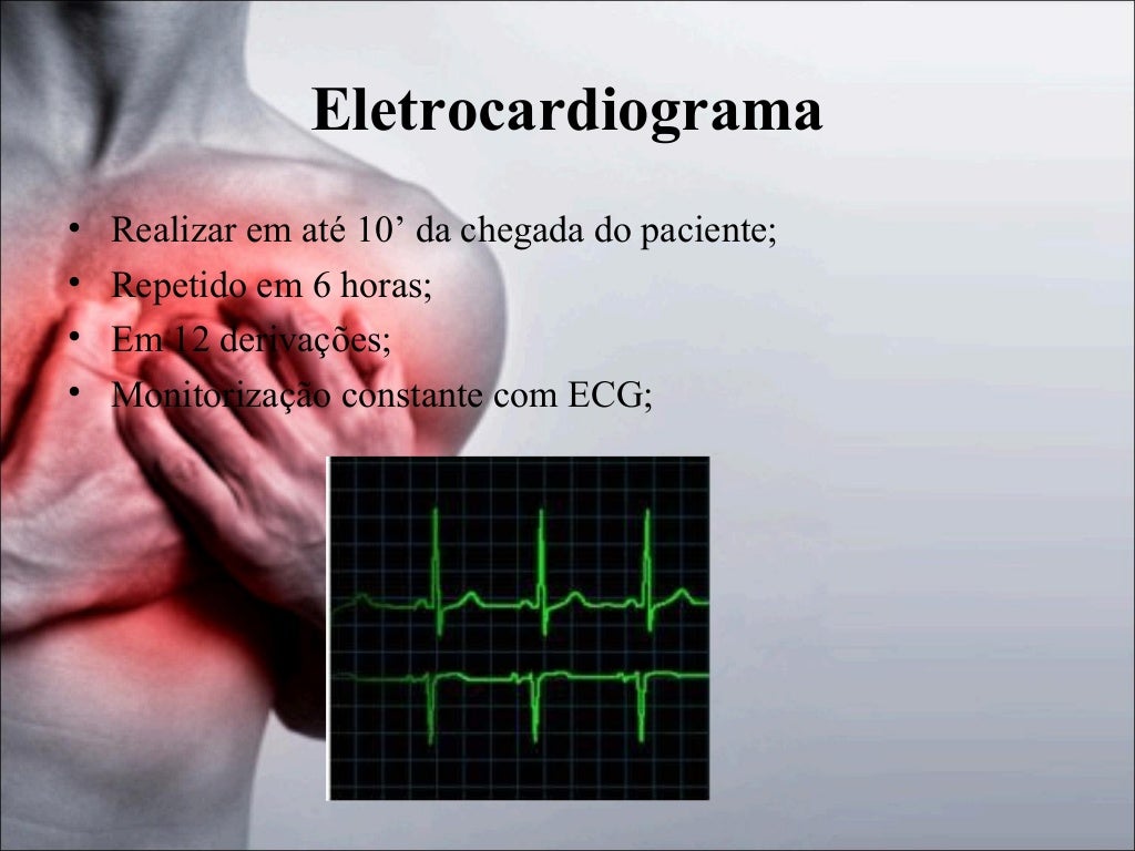 Exemplo De Prescrição De Iam Sem Supra D E St