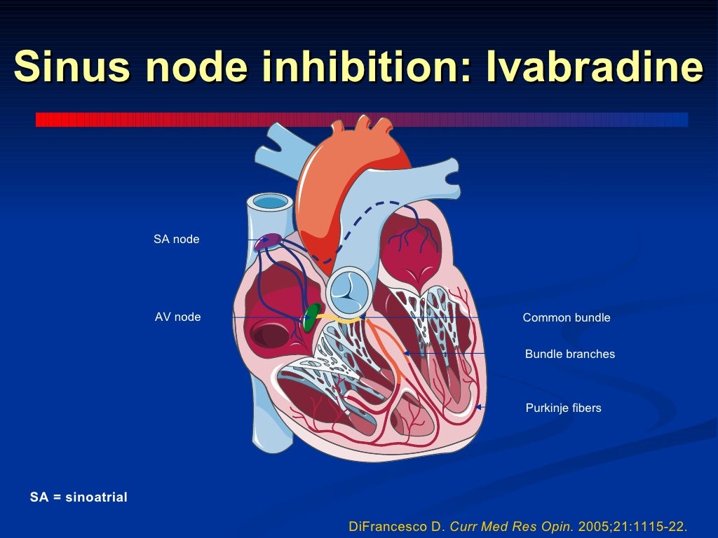 Anginal pectoris refractory to standard medical therapy i