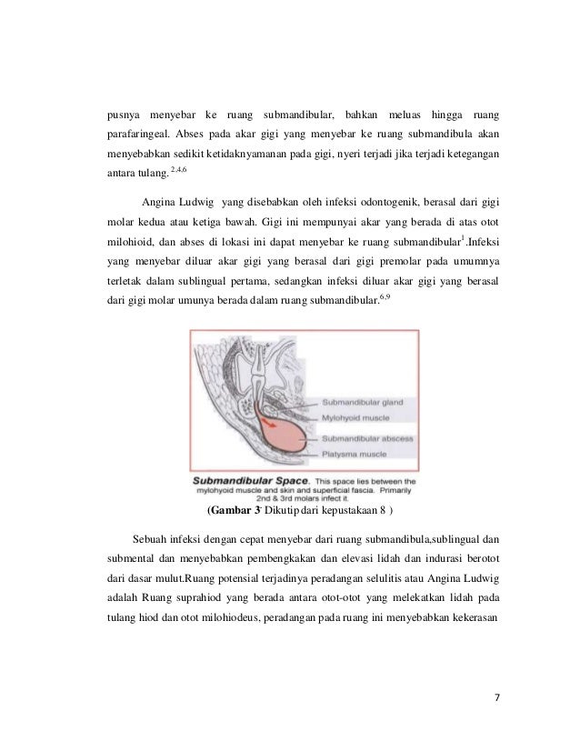 Angina ludwig referat THT