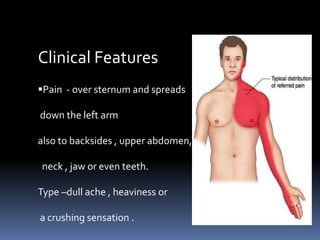 Clinical Features
Pain - over sternum and spreads
down the left arm
also to backsides , upper abdomen,
neck , jaw or even teeth.
Type –dull ache , heaviness or
a crushing sensation .
 