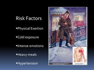 Risk Factors
Physical Exertion
Cold exposure
Intense emotions
Heavy meals
Hypertension
 