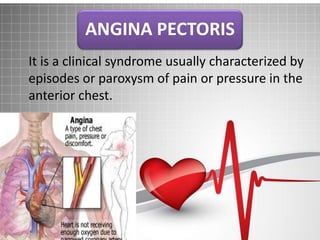 ANGINA PECTORIS
It is a clinical syndrome usually characterized by
episodes or paroxysm of pain or pressure in the
anterior chest.
 
