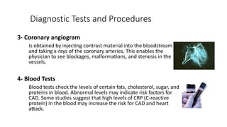 Angina pectoris | PPTX