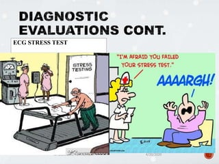ECG STRESS TEST
4/20/2020MYOCARDIAL INFARCTION 17
 