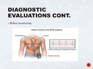  Holter monitoring
 