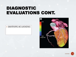 DIAGNOSTIC
EVALUATIONS CONT.
 ISOTOPE SCANNING
4/20/2020 19
 
