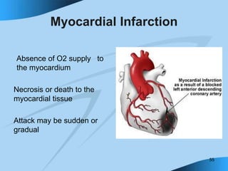 55
Myocardial Infarction
Absence of O2 supply to
the myocardium
Necrosis or death to the
myocardial tissue
Attack may be sudden or
gradual
 