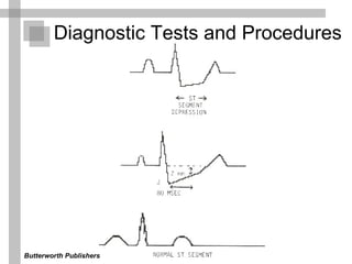 Diagnostic Tests and Procedures  Butterworth Publishers  