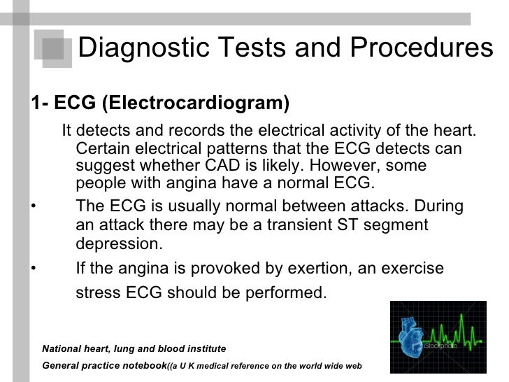Angina pectoris presentation