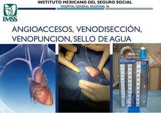 INSTITUTO MEXICANO DEL SEGURO SOCIAL
HOSPITAL GENERAL REGIONAL 46

ANGIOACCESOS, VENODISECCIÓN,
VENOPUNCION, SELLO DE AGUA

 