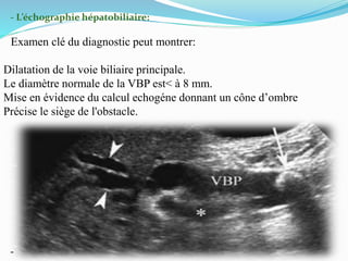 - L’échographie hépatobiliaire:
Examen clé du diagnostic peut montrer:
Dilatation de la voie biliaire principale.
Le diamètre normale de la VBP est< à 8 mm.
Mise en évidence du calcul echogéne donnant un cône d’ombre
Précise le siège de l'obstacle.
-
 