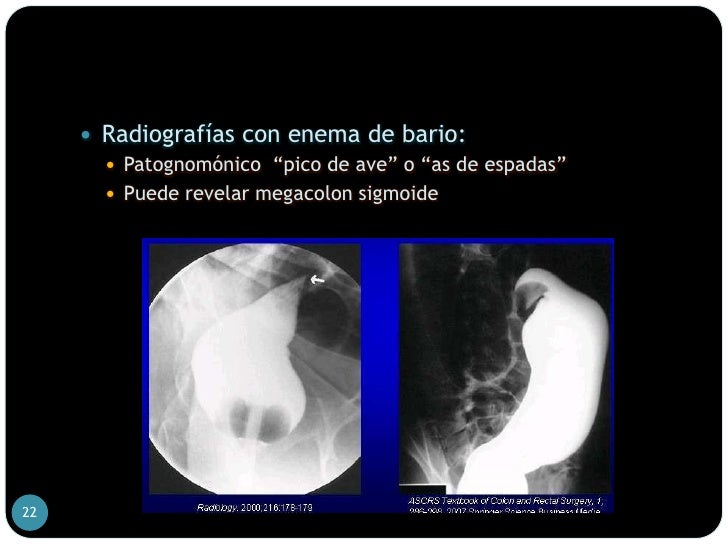 Imagen En Pico De Pajaro Volvulo