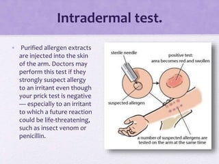 Intradermal test.
• Purified allergen extracts
are injected into the skin
of the arm. Doctors may
perform this test if they
strongly suspect allergy
to an irritant even though
your prick test is negative
— especially to an irritant
to which a future reaction
could be life-threatening,
such as insect venom or
penicillin.
 